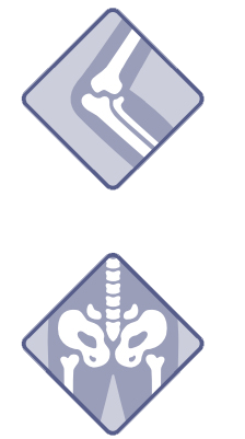 x-rayed pelvis region including hips, spine and femur
